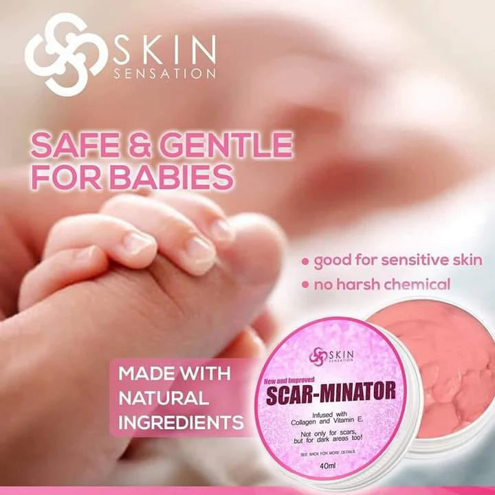 Scar-Minator 50ml