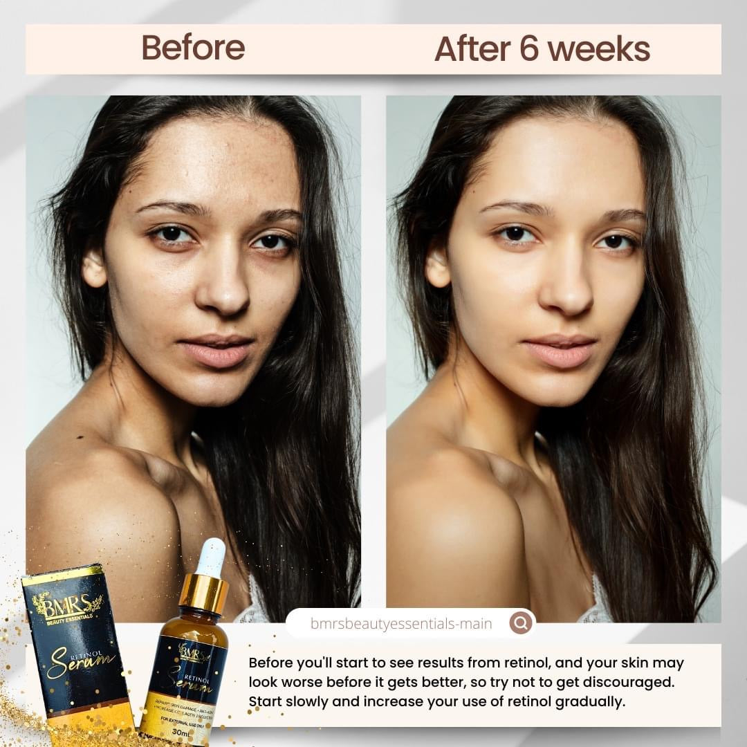 Retinol Serum 30ml