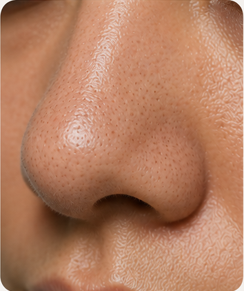 Congested Pores