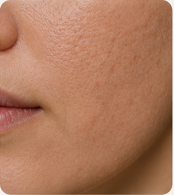 Uneven Texture