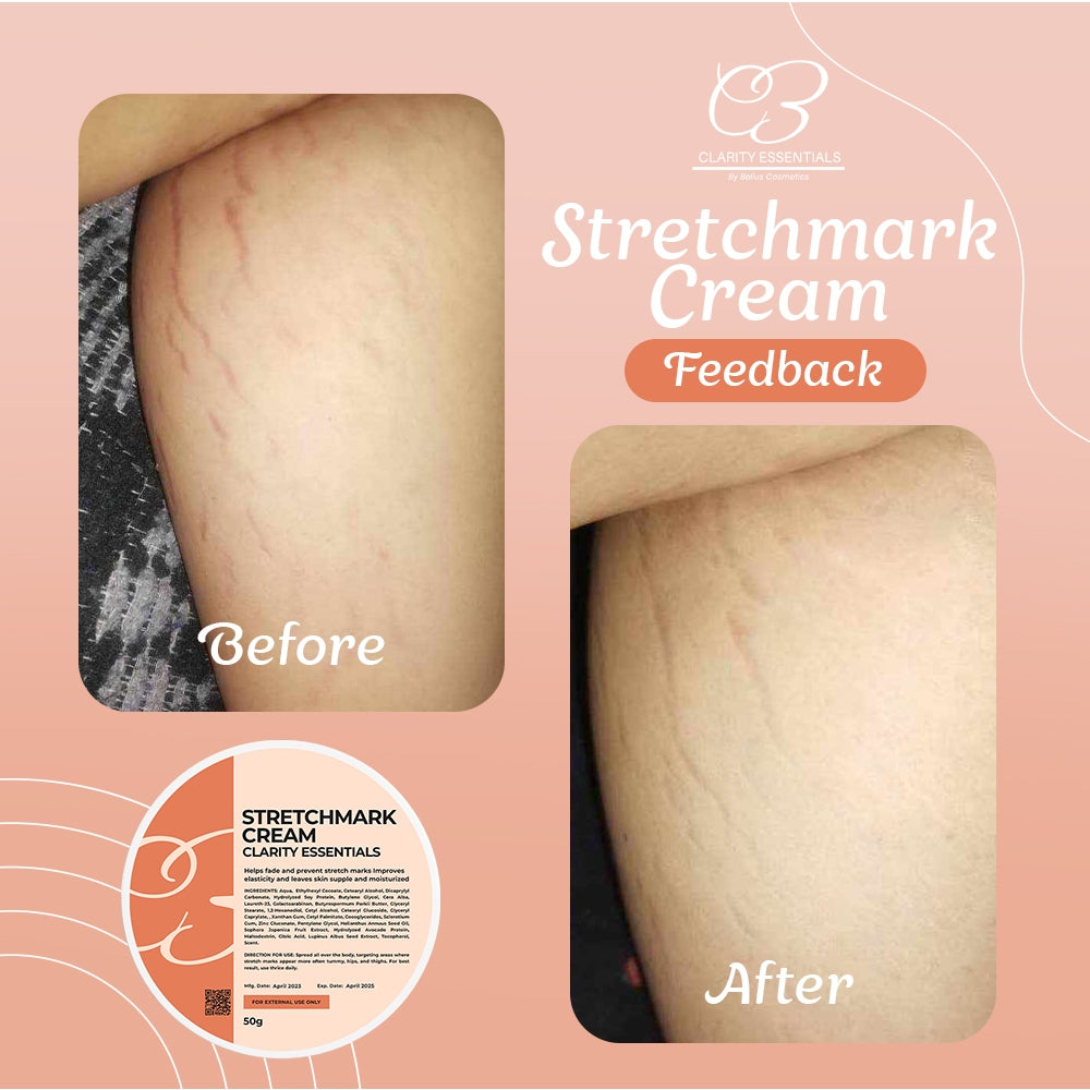 Stretchmark Cream 50g
